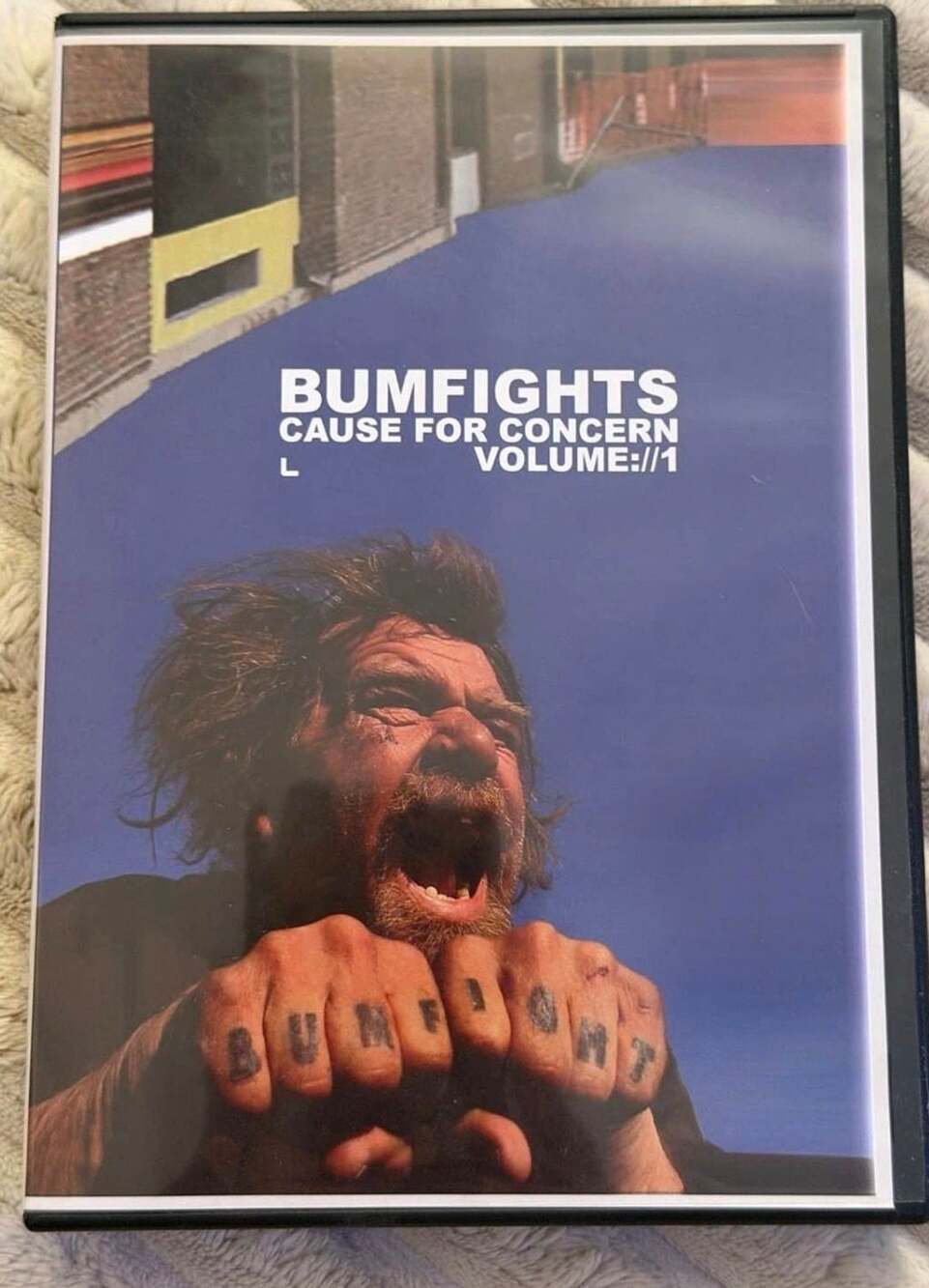 Bumfights Cause For Concern Volume 1 DVD